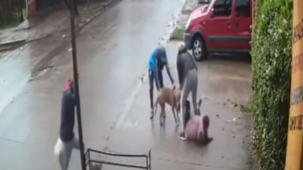 VIDEO: Niña de siete sufre ataque de un pitbull y casi pierde la pierna