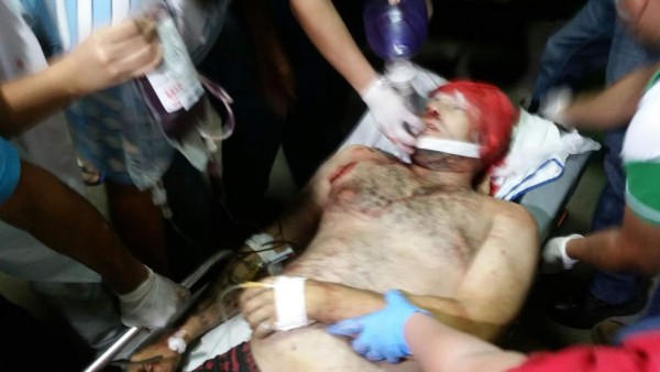 Dejan herido de varios balazos a joven cohetero en Santa Bárbara