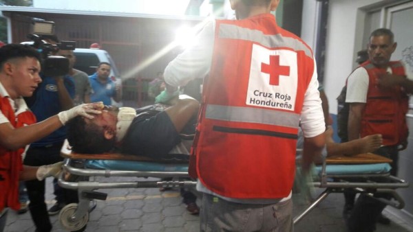 Accidente en la CA-5 deja al menos seis heridos