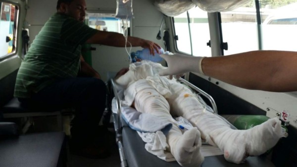 Muere padre de tres niños quemados en cohetería