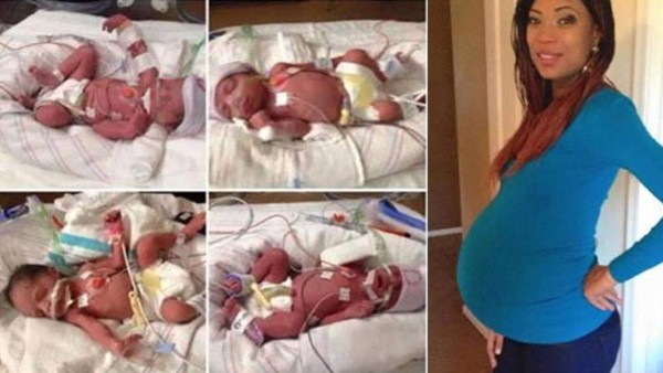 Una mujer muere horas después de dar a luz a sus cuatrillizos en EUA