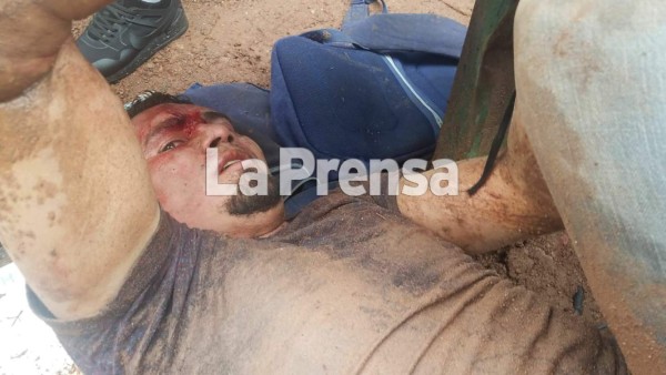 Policía salva de morir linchado a presunto delincuente en Tegucigalpa