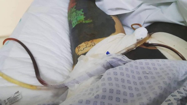 Hombre extirpó sus genitales porque no dejaban apreciar sus tatuajes