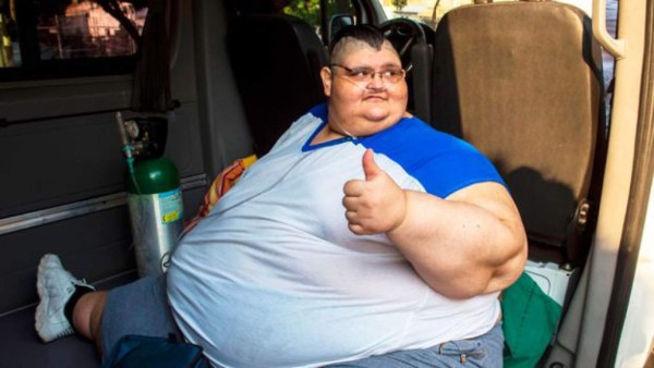 Así luce el hombre más obeso del mundo tras segunda cirugía en México