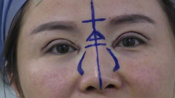 El boom de la cirugía estética en China