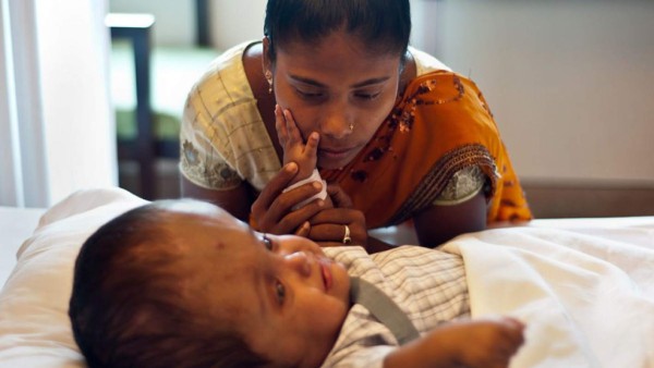 Muere Roona, la niña india afectada de hidrocefalia