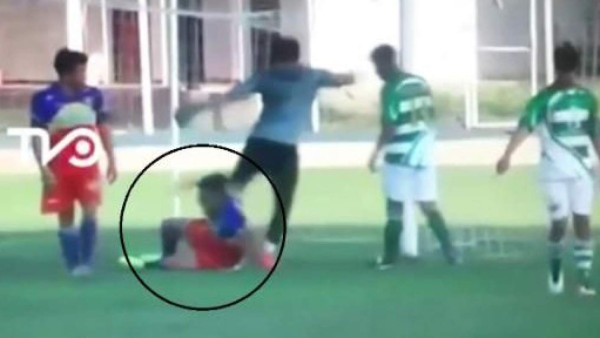 Video: Delantero terminó con fractura de cráneo tras brutal patada