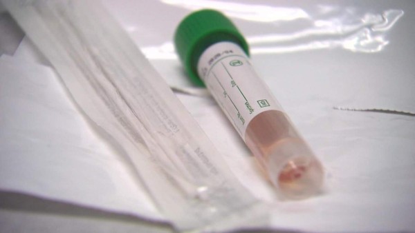 La FDA advierte sobre los falsos kits de pruebas para el COVID-19