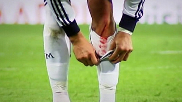 Cristiano Ronaldo sufre un corte y es duda por la Champions League