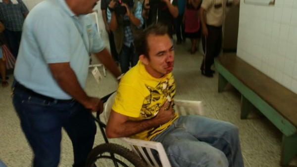 Accidente de bus deja 20 heridos en Santa Bárbara