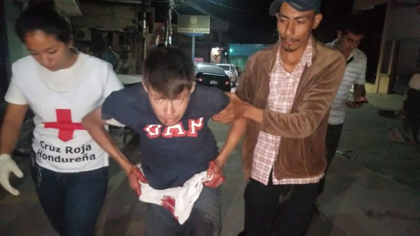 Hondureño se corta sus genitales en Copán