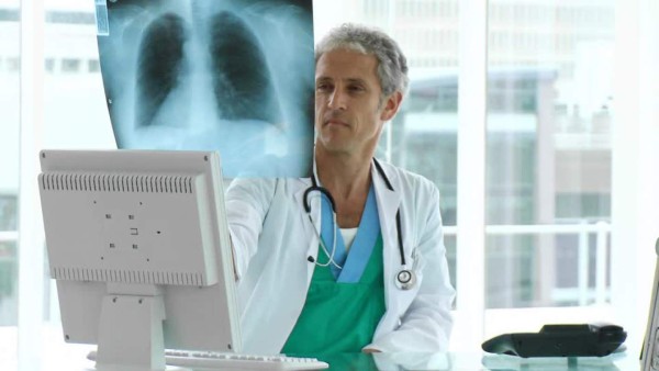 Los fumadores con neumonía están en riesgo de cáncer de pulmón