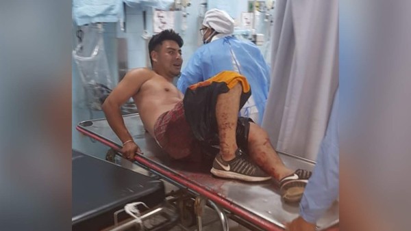 Supuestos pandilleros de la MS emboscaron a policías en Tegucigalpa