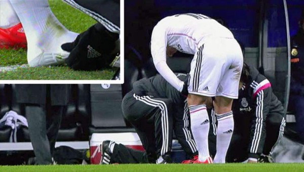 James Rodríguez, dos meses de baja en el Real Madrid