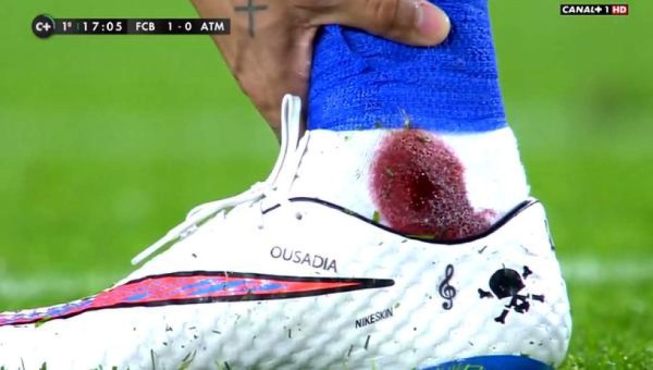 Neymar con el tobillo ensangrentado tras fuerte falta