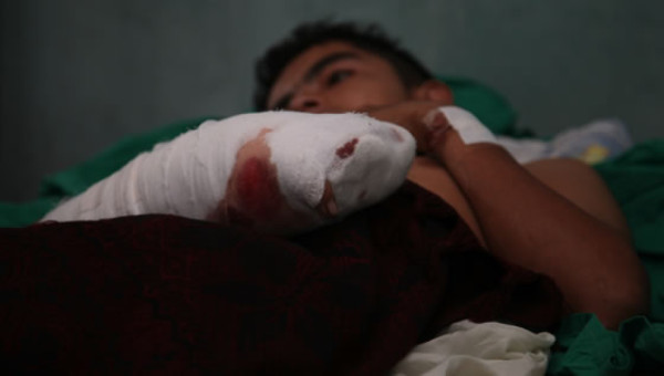 Tres menores más llegan quemados al Rivas