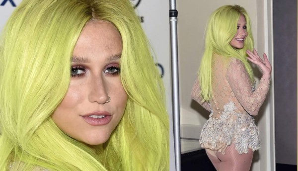 El nuevo look de Kesha ahora es verde limón