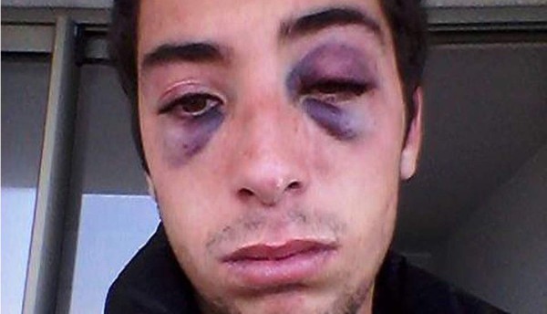 Joven publica golpiza que recibió de su exnovia