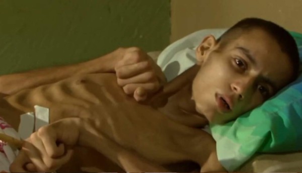 Joven hondureño vive postrado en cama tras brutal golpiza en México