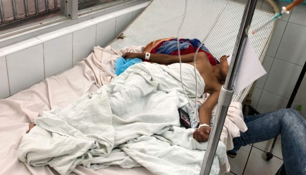 Niño de 9 años resulta quemado con pólvora