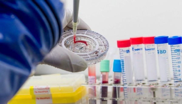 OMS lanzará equipos baratos para hacer exámenes de ébola