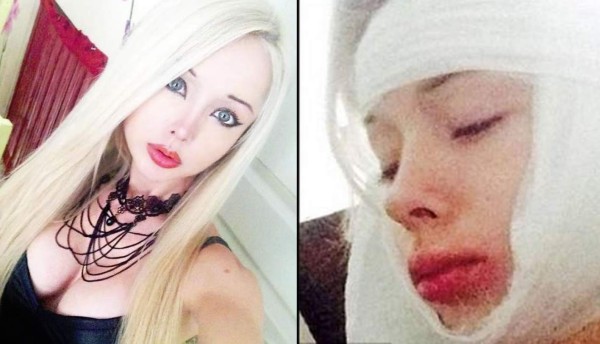 Golpean a la 'Barbie humana'