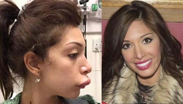 Farrah Abraham reaparece tras fallida operación de labios