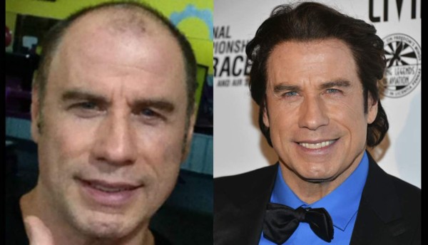 John Travolta ¿calvo?