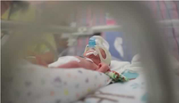 La historia de un bebé prematuro que sobrevivió con peso menor de dos libras