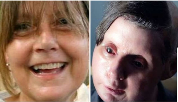 Vídeo: La mujer a la que un chimpancé le arrancó la cara y las manos