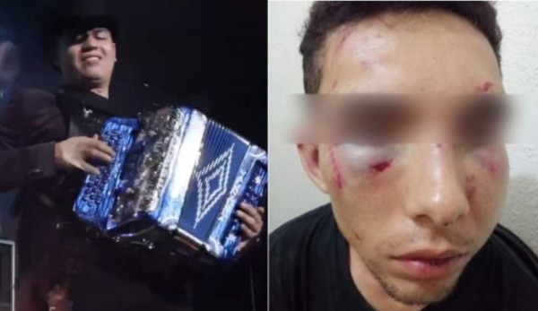 FOTOS: Remmy Valenzuela es acusado de golpear brutalmente a su primo y a su novia