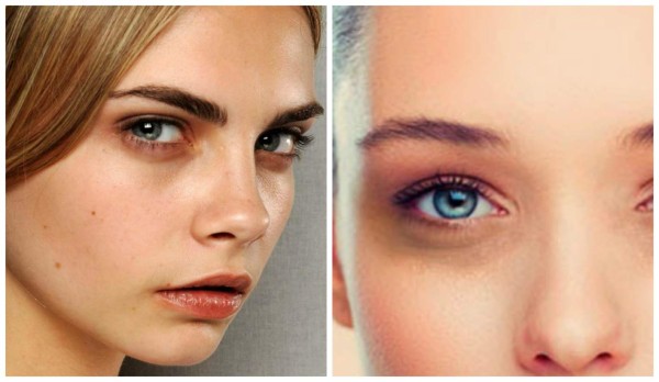 Ponle un alto a las bolsitas y ojeras con la leche