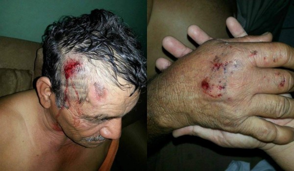 Imprudencia de rapidito casi le cuesta la vida a anciano en San Pedro Sula