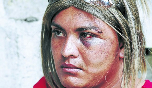 'Miré la muerte”, dice transexual agredido por médico y militares
