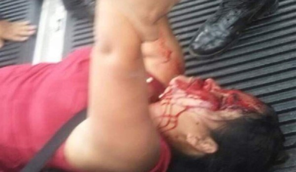 Marchas en Tegucigalpa dejan a una mujer herida