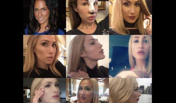 Gasta 25 millones de dólares para parecerse a Bella Hadid