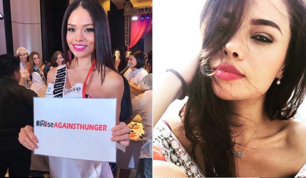 Miss Honduras desmiente polémica sobre implantes