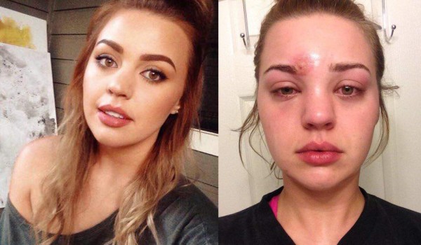 Un pequeño 'error' de belleza casi le cuesta la vida