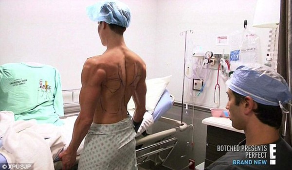 El ‘Ken humano’ se implantó alas para parecerse a un ángel