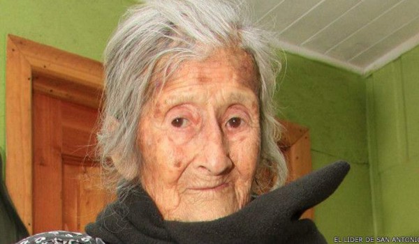 Hallan feto momificado en vientre de una anciana de 91 años