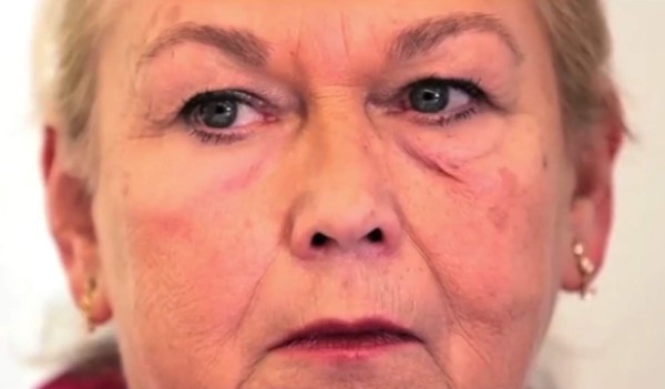 Crean una 'piel plástica' que vuelve invisible las arrugas