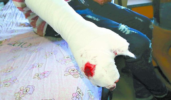 ¿Cree que es necesario multar a los padres de niños quemados por pólvora?