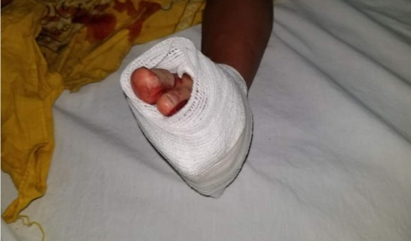 Disparos al aire de 'encapuchados' por poco matan a una niña de tres años