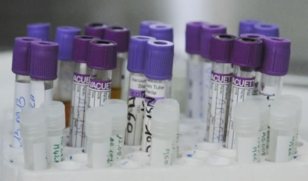 Epidemia del sida podría finalizar en 2030