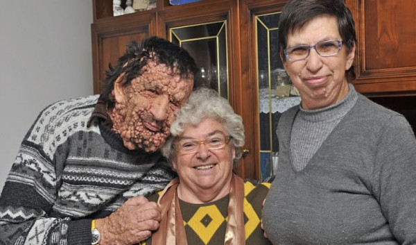 Vinicio Riva habla sobre su encuentro con el Papa: 'Yo sentía sólo amor'