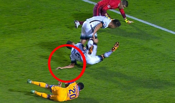 Video: Impactante lesión de mexicano en el brazo izquierdo