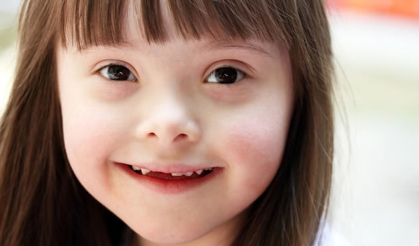 Presentan avances en terapia contra el síndrome Down