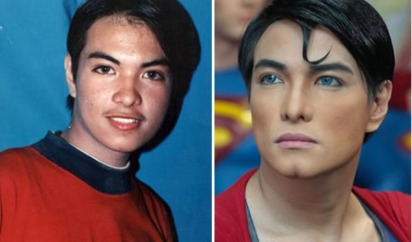 Se somete a 19 cirugías para parecerse a Superman