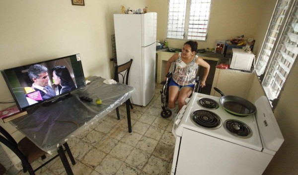 Mujer que marido le cortó los pies vuelve a la vida