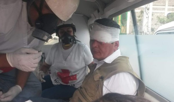 Cinco detenidos y varios heridos dejan enfrentamientos en Tegucigalpa
